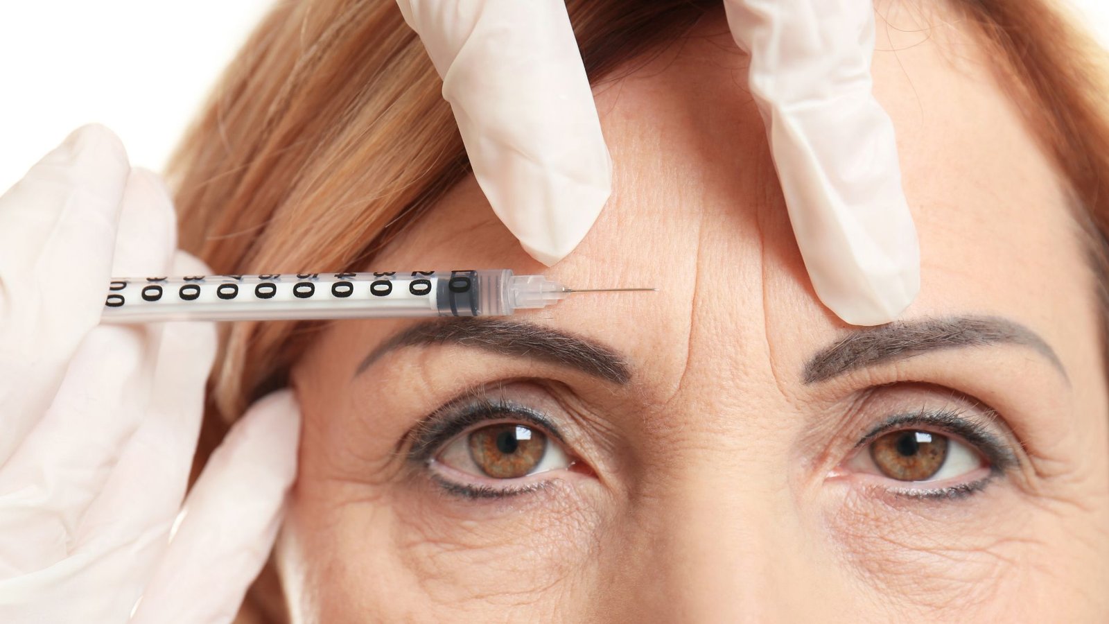 Encontre o melhor tratamento para flacidez facial em Ribeirão Preto. Opções eficazes e seguras para revitalizar sua pele!