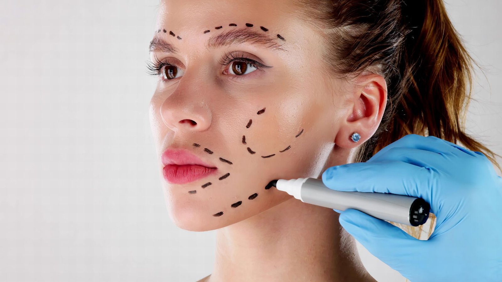 Melhor clínica para lifting facial em Ribeirão Preto, com avaliação individualizada no Instituto Mairake.